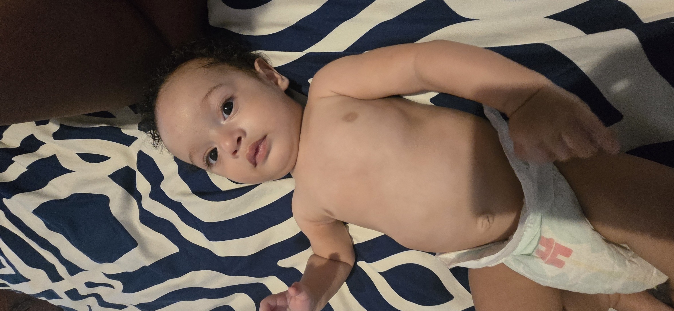 The day we noticed something wasn't right. Chest asymmetry visible.