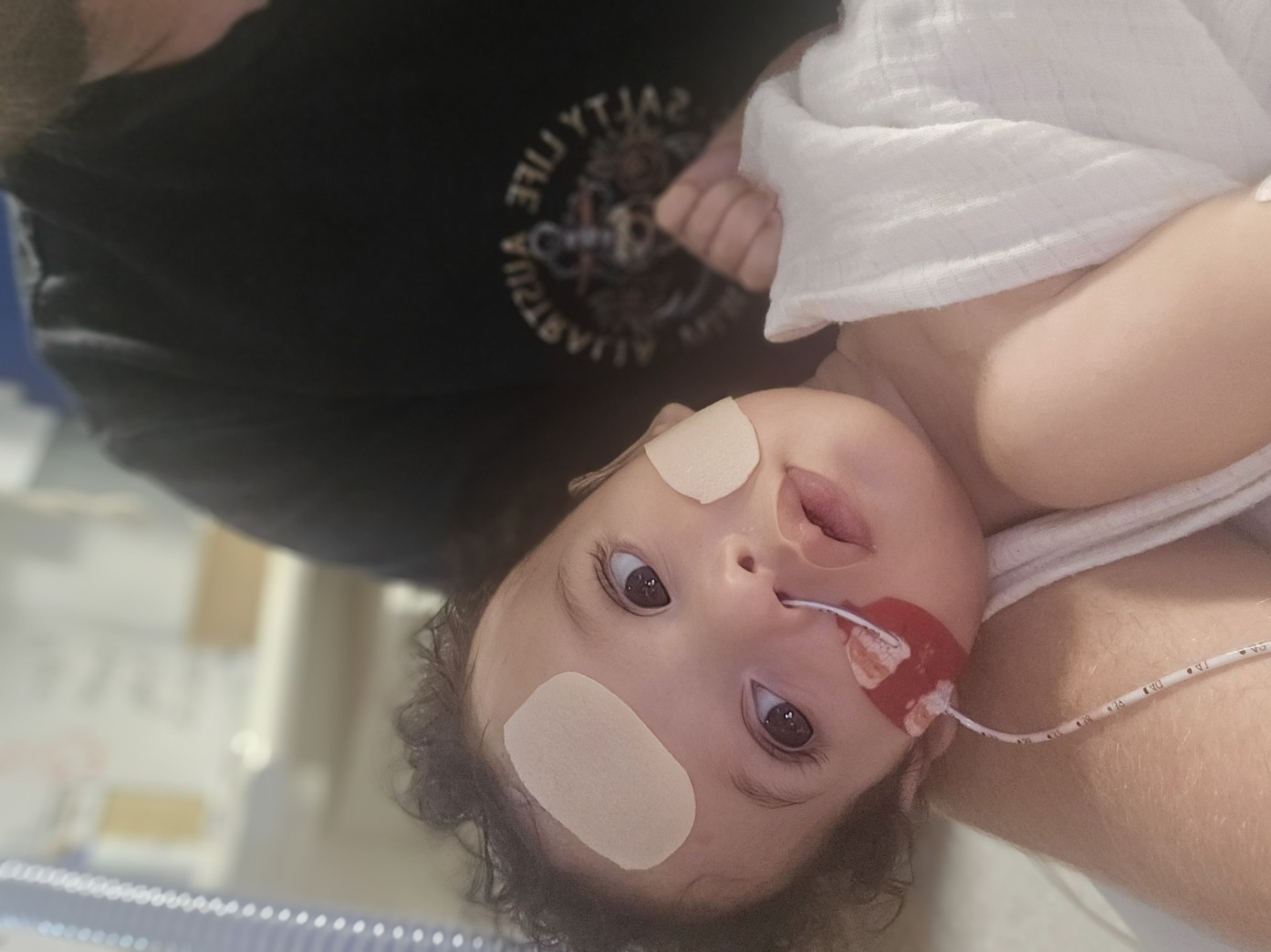 Wide-eyed and alert with Dad. NG tube and bandages — the look of a fighter.