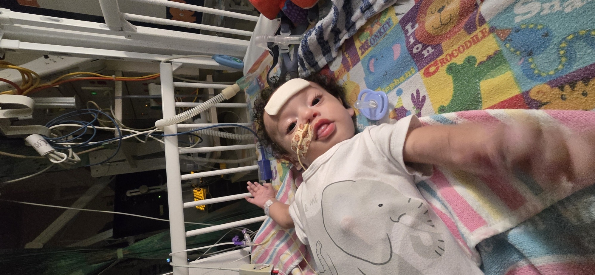 Moved to the ward! Reaching out, CPAP on, surrounded by colourful toys.